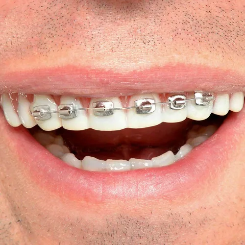 Vista 3 de Todos los apoyos falsos dientes (estándar) de Billy Bob