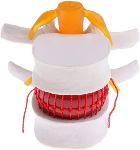 Vista 5 de Modelo de columna vertebral de hernia de disco lumbar, aumento 1.5X anatómica hernia lumbar humana disco intervertebral para enseñanza escolar