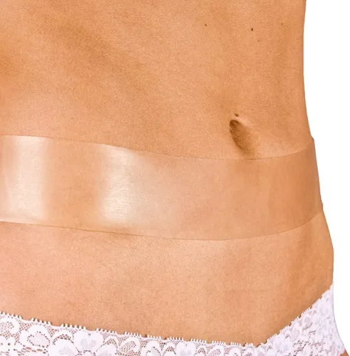 Vista 3 de NewGel - Cinta profesional de silicona avanzada para tratamiento de cicatrices por MyNewGel, ultra gruesa, para abdomen, sección C, queloides
