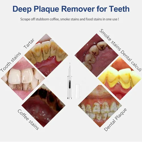 Vista 6 de Removedor de placa profesional para dientes, herramienta inteligente de limpieza de dientes activada por contacto