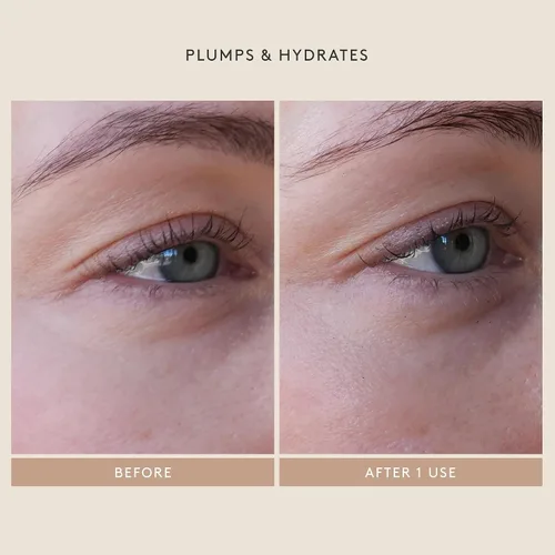 Vista 5 de Shani Darden Crema de péptidos de hidratación, hidratante facial sin aceite con péptidos, escualano, niacinamida y ceramidas para piel normal a