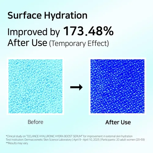 Vista 5 de Hyaluronic Hydra Boost - Suero con 10 ácidos hialurónicos, niacinamida, pantenol, ligero, hidratante para una piel brillante, no graso, sin