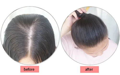 Vista 7 de 2 clips en la parte superior de cabello humano con cierre de peluca para cabello fino de 10 pulgadas para mujer (marrón oscuro)