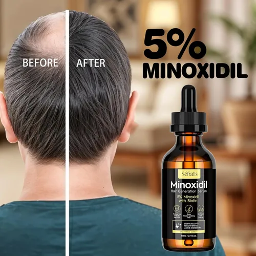 Vista 6 de 5% Minoxidil Suero de Crecimiento Capilar en Aceite para Hombres y Mujeres, Suero Capilar de Biotina, Tratamiento de Recrecimiento Capilar Más