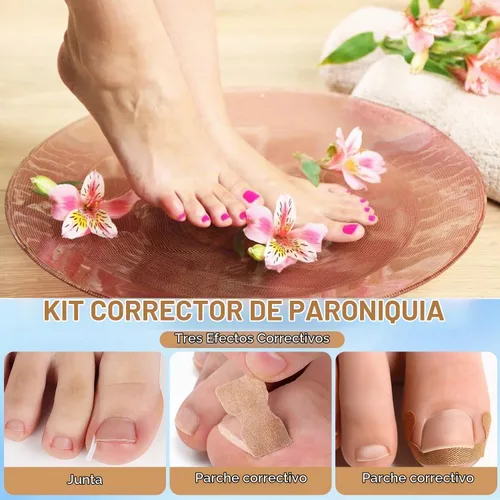 Vista 2 de Juego de corrector de uñas encarnadas con tiras correctoras, kit de eliminación de uñas encarnadas, parche corrector, herramientas de pedicura