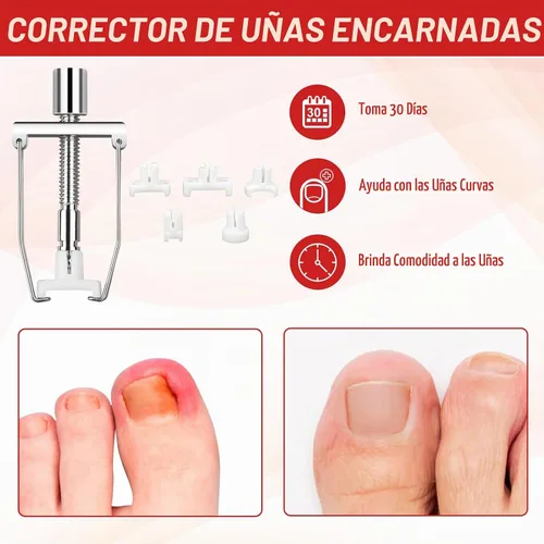 Vista 7 de Kit de eliminación de uñas encarnadas, kit de herramientas de uñas encarnadas con corrector de uñas encarnadas, gotas de uñas encarnadas, parche