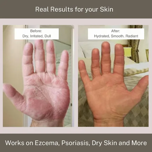 Vista 9 de InfiniteAloe, Hidratante corporal y facial de aloe vera, crema facial sin fragancia, crema corporal, loción de manos para piel seca, 4 frascos