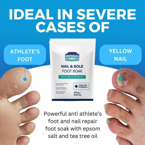Vista 7 de Imperial Feet Epsom Salt Foot Soak (grado pedico): reparación de uñas de los pies, pie de atleta de hongos, suaviza callos, pies cansados