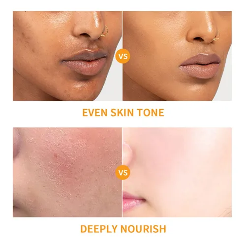 Vista 3 de Baorder Juego de 6 piezas de cuidado de la piel hidratante con vitamina C, kit de cuidado facial que incluye suero, crema facial, crema para ojos