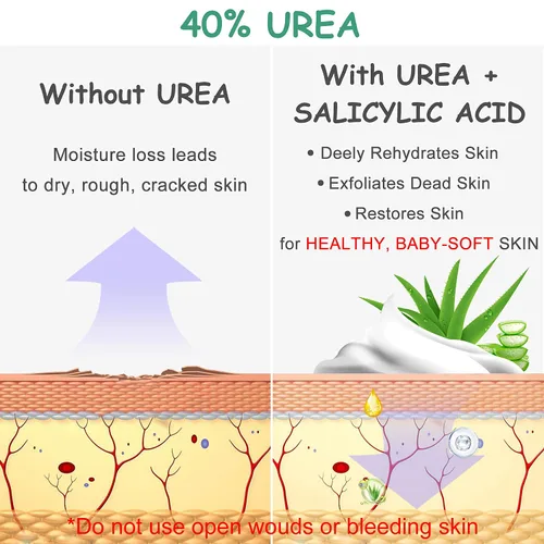 Vista 3 de Crema de urea 40 por ciento para pies, crema para pies, 40% loción de urea para piel seca/talones agrietados/pies ultra callosos, suaviza la piel