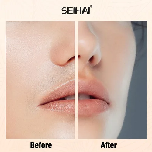 Vista 6 de Depilación facial para mujeres, dispositivo de depilación, removedor de pelo recargable SEIHAI para mujeres, removedor de vello facial para cara