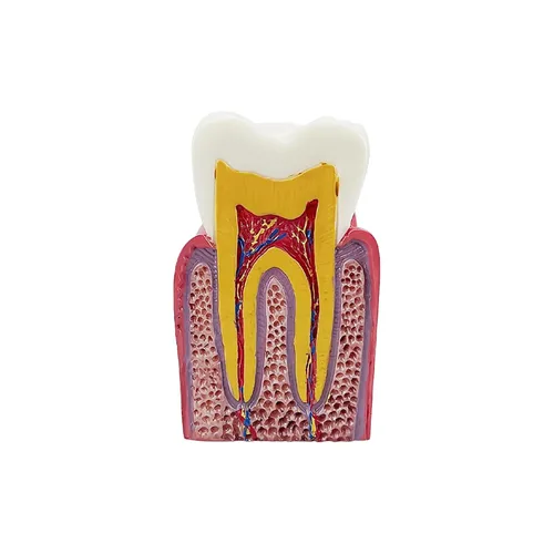 Vista 6 de Modelo de dientes de caries dental, modelo YOUYA DENTAL 6 veces de dientes de caries modelo de anatomía dental para educación de dientes