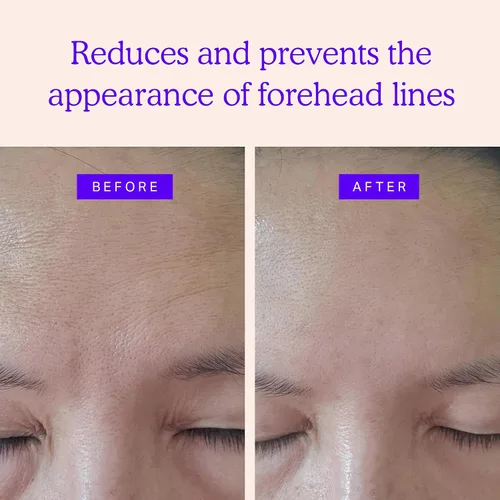 Vista 2 de Blumbody Parches antiarrugas para la frente, parches faciales antiarrugas para suavizar los ojos y las arrugas de la frente, cinta facial sin