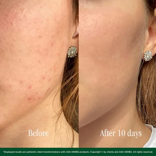 Vista 4 de Crema de noche con aceite de argán y miel, hidratante facial antienvejecimiento para piel seca y sensible, crema reparadora orgánica con manteca