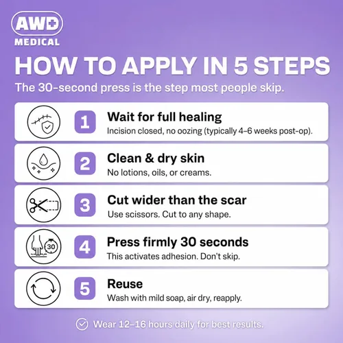 Vista 4 de AWD - Láminas de silicona para cicatrices quirúrgicas, cinta de silicona precortada de grado médico para cesárea, cinta de abdominoplastia, parches