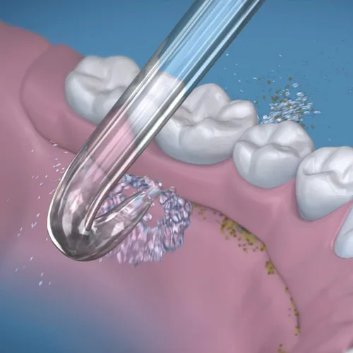 Vista 7 de Waterpik El irrigador dental acuario + puntas de reemplazo de prótesis de implantes - El sistema eléctrico de higiene dental elimina hasta el 99.9%