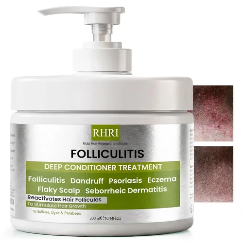 Vista 7 de Foliculitis Scalp Spray Tratamiento de la caspa para cuero cabelludo seco e irritado