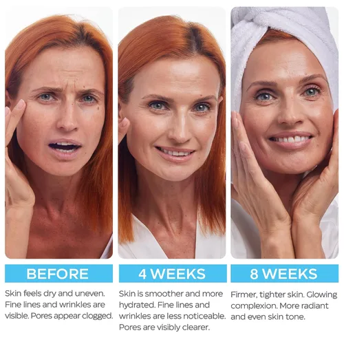 Vista 7 de Crema de retinol para cara con ácido hialurónico – Hidratante facial de colágeno para mujeres y hombres – Fórmula avanzada antienvejecimiento