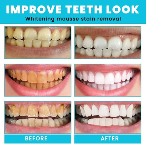 Vista 3 de Mousse blanqueador de dientes – Espuma refrescante de limpieza profunda para el aliento Pasta de dientes Natural Agua de lavado bucal Espuma