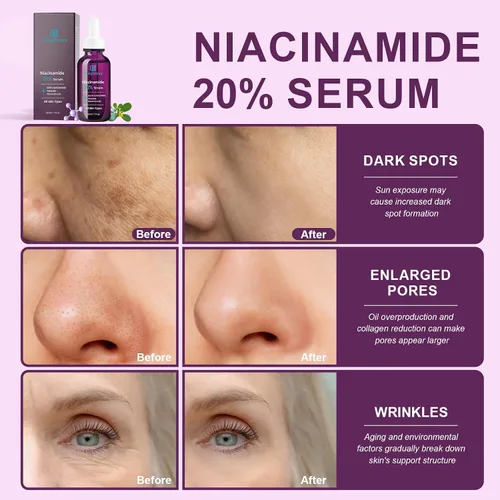 Vista 4 de 20% suero de niacinamida para la cara,Niacinamida Vitamina B3 B5 suero concentrado,Hidratante,Minimizador de poros,Tratamiento de corrección