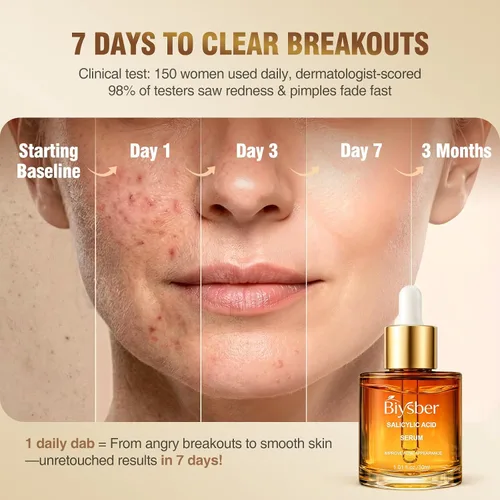 Vista 2 de Solución de suero de ácido salicílico al 2% para la cara: Suero facial exfoliante suave para el acné, puntos negros y poros abiertos y reduce