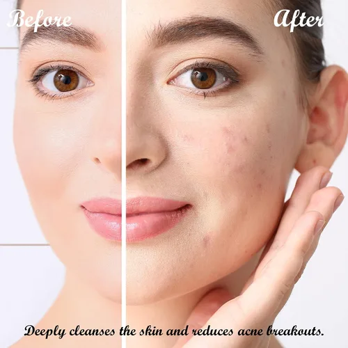 Vista 7 de Dr Joe Lab Bálsamo limpiador para la cara limpia, hidrata y elimina el maquillaje y los productos acumulados – el embalaje puede variar.