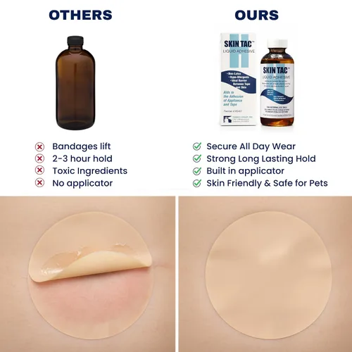 Vista 6 de >Skin tac adh 4 oz. Skin-Tac-H