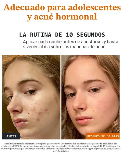 Vista 5 de Norse Organics Bálsamo nocturno para espinillas, tratamiento de manchas de acné para enrojecimiento y calmante de la piel, ingredientes bioactivos