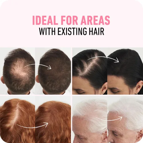 Vista 4 de BOLDIFY Fibras capilares (1.01 oz) – Rellena el cabello fino y fino para un aspecto más completo y grueso al instante – 14 tonos para mujeres