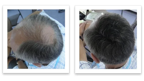 Vista 3 de Ocultador de pérdida del cabello Caboki (Restaura las fibras del cabello)