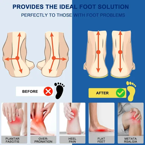 Vista 3 de Plantillas para fascitis plantar, plantillas de zapatos con soporte de arco alto para hombres y mujeres, plantillas ortopédicas de gel para correr