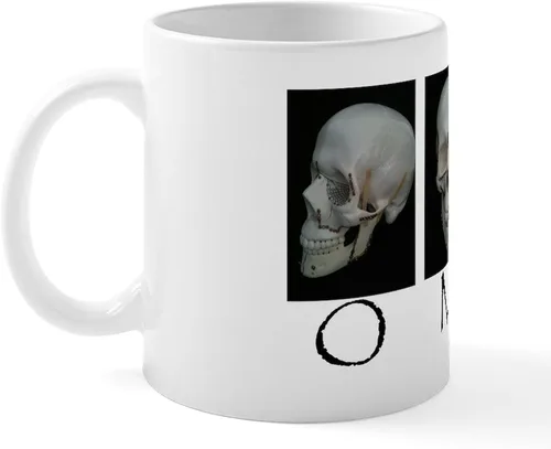 Vista 2 de CafePress OMS - Taza quirúrgica con diseño de calavera de 11 oz (11.0 fl oz)