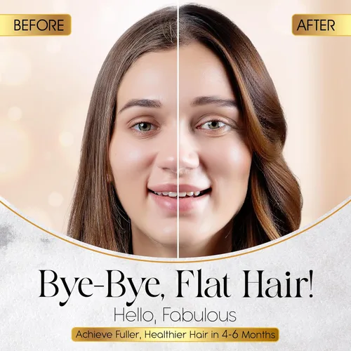Vista 4 de Nativo's Champú fortalecedor para adelgazar el cabello – Fórmula de biotina, trichogen, palma enana americana y zinc – Volumizante y engrosante