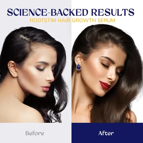 Vista 4 de Suero para el crecimiento del cabello, agua de arroz, biotina y cafeína, spray para el crecimiento del cabello para hombres y mujeres, aceites