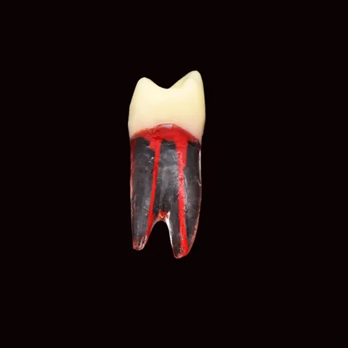 Vista 7 de 8pcs dientes modelo endodoncia endodoncia archivo RCT práctica pulpa para enseñanza estudio
