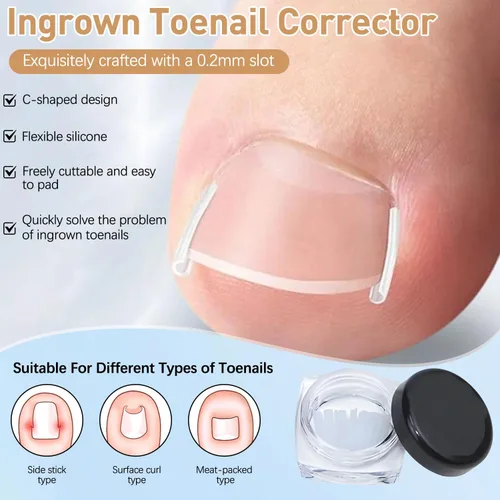 Vista 4 de Kits de corrector de uñas encarnadas con tiras curvas, parches transpirables y herramientas de pedicura, juego de cuidado de uñas para una