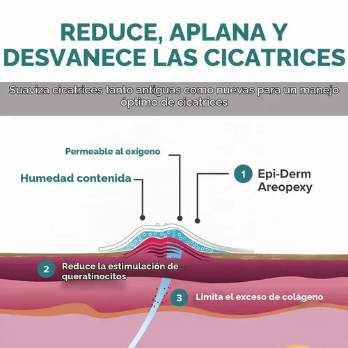Vista 3 de EpiDerm Areopexy - Cinta de silicona para cicatrices, con forma de piruleta, natural, 5 pares