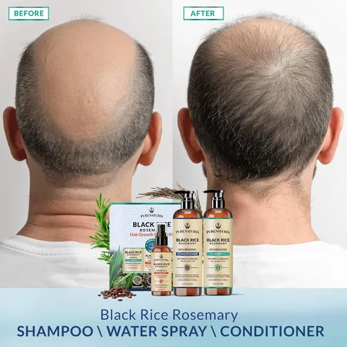 Vista 6 de PureNaturis Champú orgánico de agua de arroz negro con romero para el crecimiento del cabello, spray de agua de arroz, con agua de romero, biotina