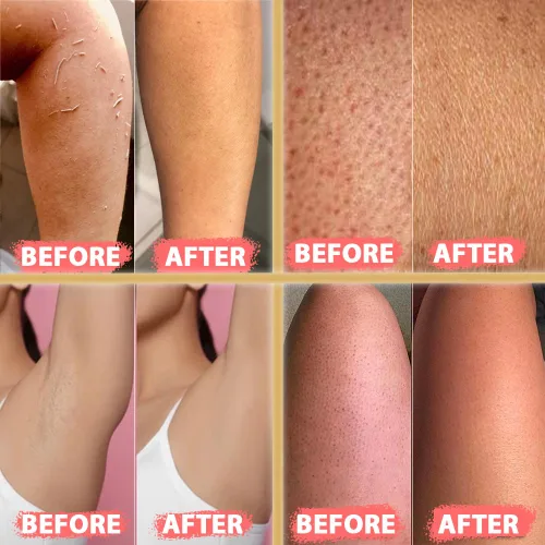 Vista 2 de Kelebek - Juego de 2 guantes exfoliantes prémium Guantes de baño de limpieza profunda para mujeres y hombres Hammam Keesa turco natural