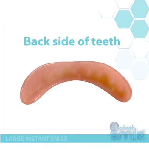 Vista 3 de Instant Smile - Chapa hecha a mano de gran tamaño - Original - ¡Arregla tu sonrisa en solo minutos!