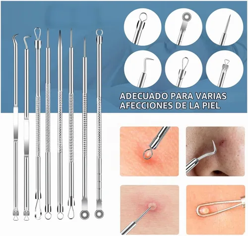 Vista 5 de Kit de herramientas para eliminar puntos negros, herramienta extractora de espinillas, herramienta extractora de espinillas, herramienta profesional