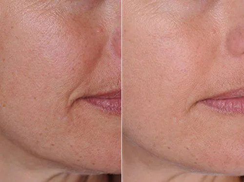 Vista 3 de DNA CODE® - Aceite de argán orgánico de día/noche Wrinke Reduce Cream, w/Argireline, M3000, Célula de tallo de manzana, ácido hialurónico