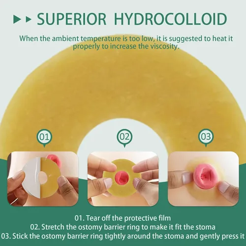 Vista 6 de 30 anillos de barrera para ostomía, sellos cohesivos de cinta hidrocoloide de 0.079 pulgadas de grosor, extensor elástico moldeable de piel