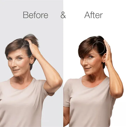 Vista 9 de Better Not Younger Suero fortificante para el cabello y el cuero cabelludo para adelgazar y envejecer el cabello, suero para cabello más fuerte