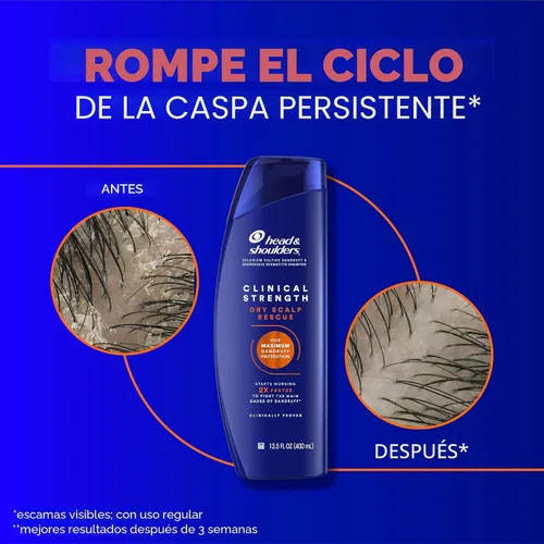 Vista 6 de Head & Shoulders - Champú y acondicionador Clinical Strength Dry Scalp Rescue, champú y acondicionador anticaspa y para el cuero cabelludo reseco