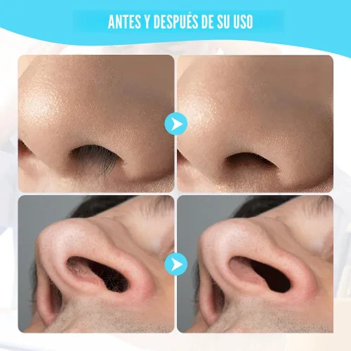 Vista 4 de Cortador de Vello Nasal para Mujeres y Hombres, Herramienta Manual Mejorada 2025 de Eliminación de Vello de Fosa Nasal Giratoria 360°, Cuchilla