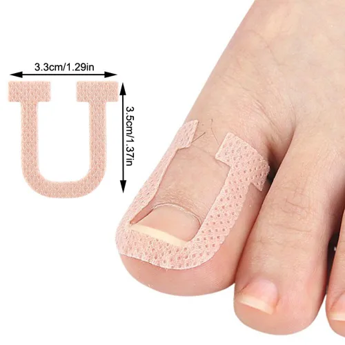 Vista 2 de Paquete de 40 parches correctores de uñas encarnadas en forma de U, correctoras de uñas de los pies, parches de corrección, vendajes para alivio