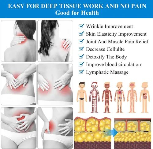 Vista 3 de Conjuntos de terapia de ventosas de silicona, kit de ventosas para terapia de masaje,Copa anticelulitis, para reducción de celulitis, dolor