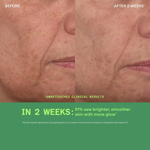 Vista 13 de Murad Vita-C Suero glicólico - Escudo ambiental iluminador de la piel Vitamina C Suero facial - Tratamiento respaldado por la ciencia