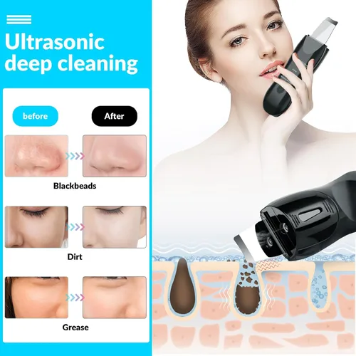 Vista 2 de Limpiador facial de piel con pulverizador, pulverizador mejorado, extractor de puntos negros para limpieza profunda e hidratante en aerosol